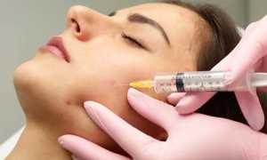 Что такое озонотерапия для лица и сколько стоит курс лечебных процедур для кожи? Узнайте больше о преимуществах