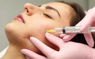 Что такое озонотерапия для лица и сколько стоит курс лечебных процедур для кожи? Узнайте больше о преимуществах