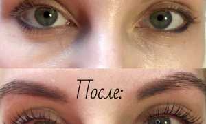 Что такое ботокс для ресниц и бровей: эффект от процедуры и отзывы с фото “до и после” для красоты