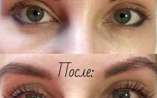 Что такое ботокс для ресниц и бровей: эффект от процедуры и отзывы с фото “до и после” для красоты