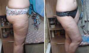 В чем суть шоколадной диеты и каких ожидать результатов если сесть на нее на 7 дней для похудения