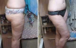 В чем суть шоколадной диеты и каких ожидать результатов если сесть на нее на 7 дней для похудения