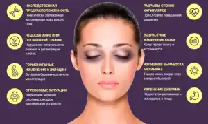 Что делать с темными кругами под глазами и как их убрать в домашних условиях: советы и рекомендации