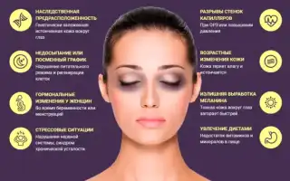 Что делать с темными кругами под глазами и как их убрать в домашних условиях: советы и рекомендации