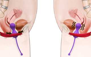 Интимная гимнастика с шариками Кегеля: что это такое и как ими правильно пользоваться для здоровья